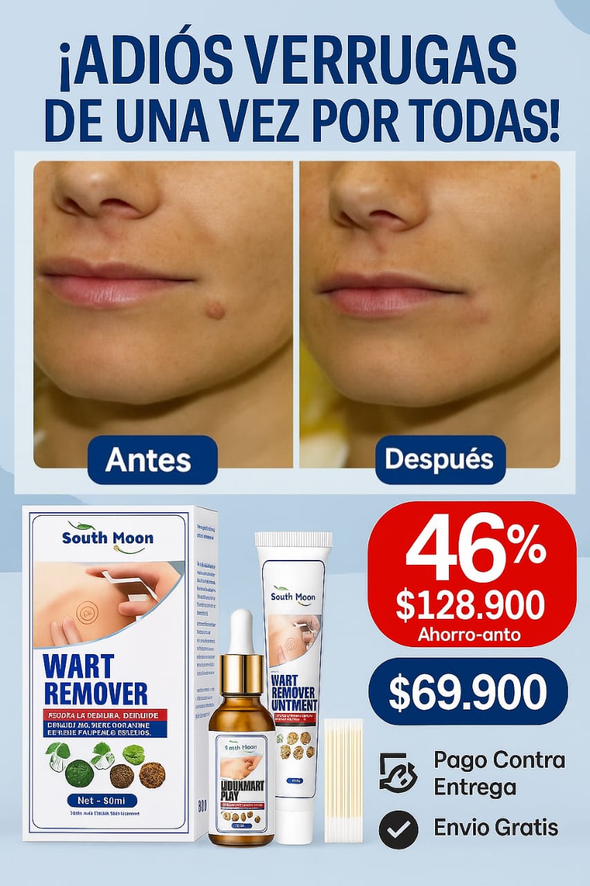 REMOVEDOR DE VERRUGAS